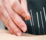 Acupuntura em Jandira